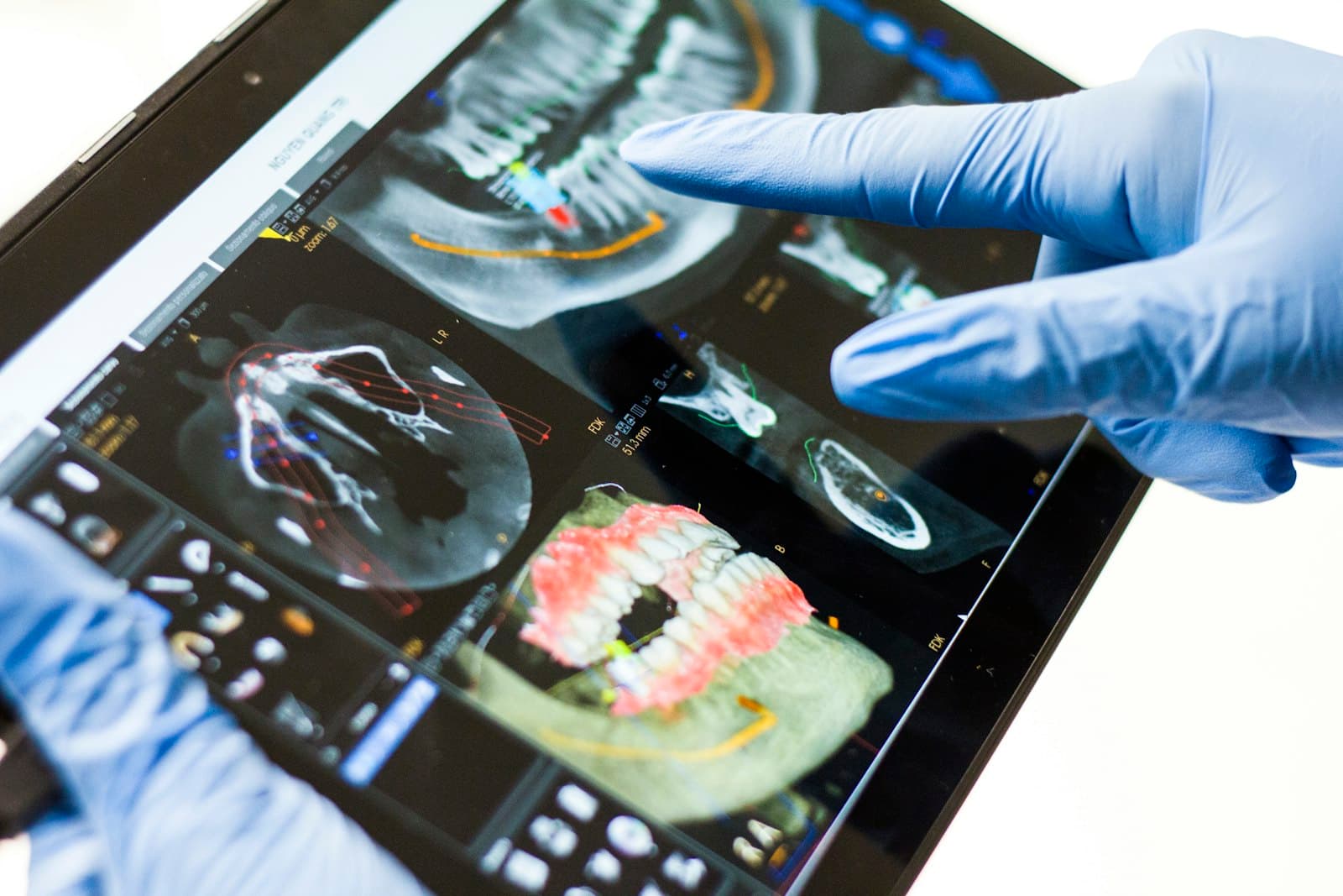 Gloved hands reviewing dental scans on a tablet